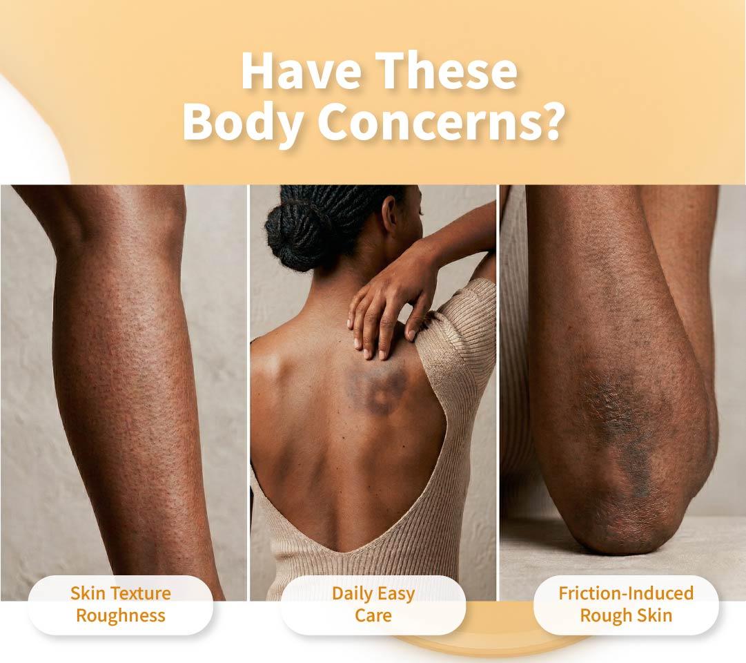 🥰Softiding Keratin Care Kojic Acid Turmeric Spray 200ml Pore Clearing Exfoliating Formula Skin Repair Scrub(Buy three, get one free)