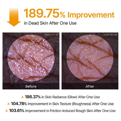 🥰Softiding Keratin Care Kojic Acid Turmeric Spray 200ml Pore Clearing Exfoliating Formula Skin Repair Scrub(Buy three, get one free)